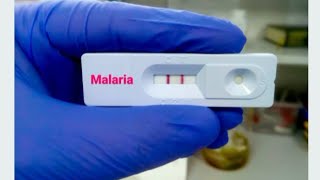 How To Use Malaria Rapid Diagnostic Test  Step by Step [upl. by Canfield]