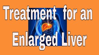 Treatment for an Enlarged Liver [upl. by Amalia77]