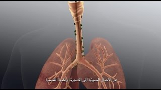 Advanced Bronchoscopy for Lung Diagnosis [upl. by Adieren214]