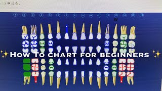 DENTAL CHARTING AND CODING FOR BEGINNERS [upl. by Moyer269]