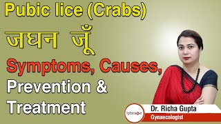 Pubic lice Crabs जघन जूँ  Symptoms Causes Prevention amp Treatment  Dr Richa Gupta  Lybrate [upl. by Esyli]