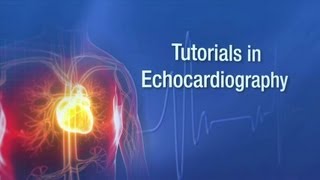 Echo Tutorials  Mayo Clinic [upl. by Ellennad]