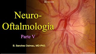 Neuroftalmología Parte V [upl. by Verene]