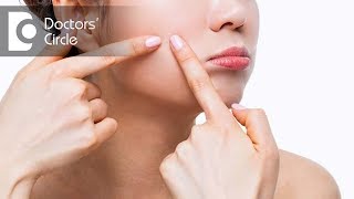 What causes hormonal acne  Dr Priya J Talageri [upl. by Acemahs]