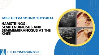 Hamstring ultrasound  Semimembranosus and Semitendinosus tendons and using Anistropy [upl. by Efron]