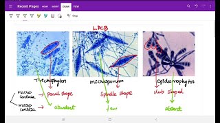 Superficial Mycoses  Microbiology fungal infections Image based discussion [upl. by Descombes]