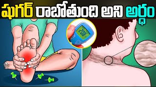 Pre Diabetes Symptoms Telugu  Early Diabetes Symptoms in Telugu  Diabetes Signs  iD Health 360 [upl. by Arhez305]