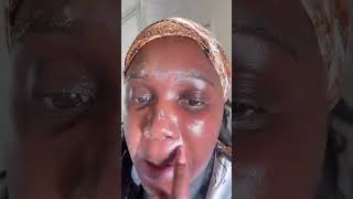 Dermal Therapy Psoriasis Cream Testimonial [upl. by Ronaele]