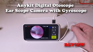 Anykit Digital Otoscope Ear Scope Camera with Gyroscope REVIEW [upl. by Lorianna]