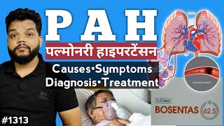 Pulmonary Hypertension  CausesSymptomsDiagnosis amp Treatment In Hindi [upl. by Florette]