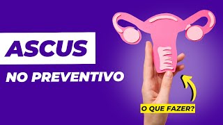 ASCUS no preventivo saiba o que fazer [upl. by Fasto]