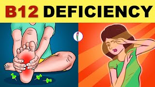 Vitamin B12 Deficiency Symptoms  B12 Deficiency  Vitamin B12  All You Need to Know [upl. by Asek]