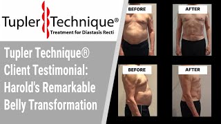 Tupler Technique® Client Testimonial Harolds Remarkable Belly Transformation [upl. by Anitsirhk977]