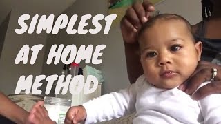 How To Treat Cradle Cap For Babies  Home Remedy [upl. by Neryt]