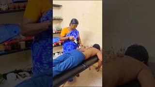 Cupping Treatment For Back Pain viralcuppingmassagetrainingchennai Healer Prabhu [upl. by Burdelle179]