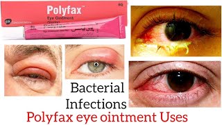 Polyfax Eye ointment Uses in Urdu Hindi [upl. by Shultz]