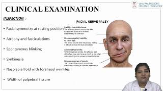 Dr Aarthee  Department of Oral and Maxillofacial Surgery  Bell’s Palsy and its Management [upl. by Vincelette]