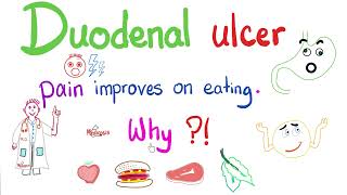 Pain of Duodenal Ulcer Improves on eating…Ever Wonder Why [upl. by Attiuqram]