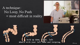 Colonoscopy Insertion Technique with Mikoto Model How to avoid loops during colonoscopy [upl. by Bergin]