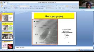 Dr Shabana lectures Anatomy Extra hepatic biliary apparatus [upl. by Ralaigh433]