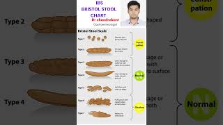 IBS 7 bristol chart interpretation [upl. by Scherle774]