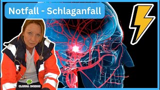 Ursachen des Schlaganfalls Apoplex [upl. by Sicard]