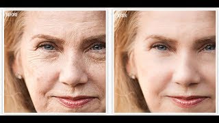 BEST ANTIAGING CREAM  AFFORDABLE  Revitol AntiAging Cream [upl. by Adriana]