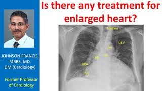 Is there any treatment for enlarged heart [upl. by Nnahoj722]