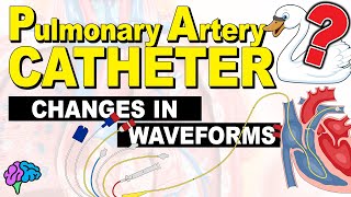 Pulmonary Artery Catheters for Critical Care Nurses [upl. by Llertnek631]