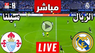 رد فعل  مباراة ريال مدريد ضد سيلتا فيغو اليوم  لعبة ريال مدريد وسيلتا فيغو اليوم [upl. by Rustin203]