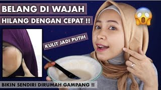 TIPS MENGHILANGKAN BELANG DI WAJAH amp MEMUTIHKAN KULIT DENGAN CEPAT MENGGUNAKAN BAHAN ALAMI [upl. by Halette900]