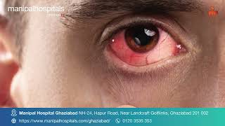 Conjunctivitis  Dr Sumit Gupta  Manipal Hospital Ghaziabad [upl. by Ajnot]