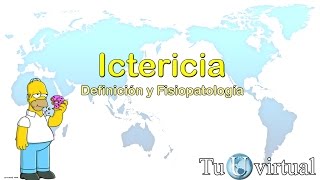 Ictericia fisiopatología y metabolismo de la bilirrubina con imágenes clínicas [upl. by Sudhir]