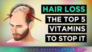 Top 5 Vitamins To PREVENT Hair Loss [upl. by Ennaeus]