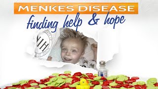 Menkes Disease Finding Help amp Hope Documentary  3 minute Trailer [upl. by Kceb201]