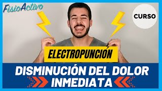 3 BENEFICIOS e Indicaciones de la ELECTROPUNCIÓN ⚡💪🏼 Fisioterapia Experiencia Clínica [upl. by Akram]