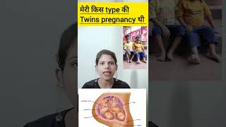 meri kis type ki twins pregnancy thi dichorionic diamniotic twins pregnancy ka kya matlab hota hai [upl. by Gracye116]