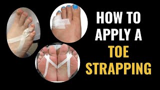 How Do I Do Toe Strapping Dislocated and Fractured Toe [upl. by Rubel]