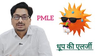 धूप की एलर्जी  Polymorphous light Eruption  Sunlight Allergy  PMLE Ultraviolet किरणों की एलर्जी [upl. by Gawain]