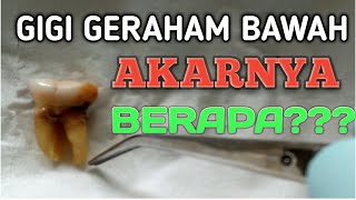 GIGI GERAHAM BAWAH AKARNYA BERAPA [upl. by Oek]