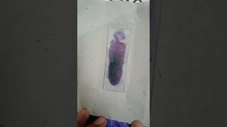 Peripheral Blood Smear for determining Differential Leucocyte count [upl. by Inava10]