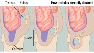 Testes descend Part 01  2nd Year MBBS OSPE Embryology [upl. by Enala384]