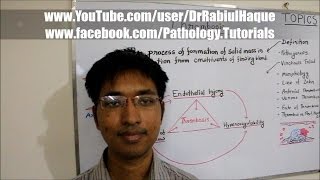 Thrombosis  Definition Pathogenesis Morphology amp Fate HD [upl. by Alrahs667]