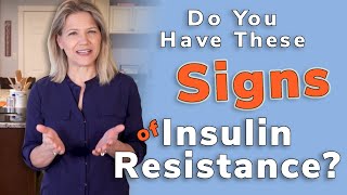 Signs of Insulin Resistance – Do You Have Them [upl. by Spitzer]