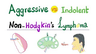 NonHodgkins Lymphoma  Aggressive type VS Indolent type  Hematology and Oncology [upl. by Descombes588]