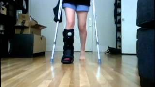 Walking After Ankle Surgery Days 1 amp 2 [upl. by Ewer376]