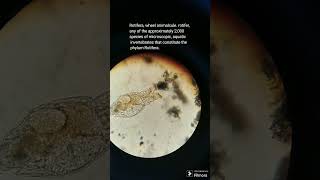 Rotifera microscopic view 400X [upl. by Nnyled689]