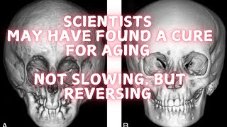 Scientists may have found a cure for aging [upl. by Lucrece]