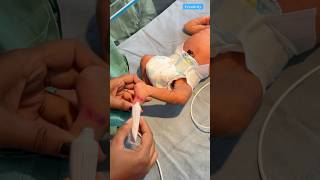 Wound Repair medical newbornbaby viralvideo [upl. by Ivzt]