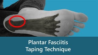 Plantar Fasciitis Taping Technique [upl. by Smeaj]